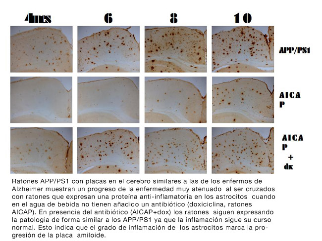 El proceso inflamatorio en la astroglia juega un papel fundamental en el desarrollo de la demencia de Alzheimer