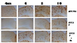 El proceso inflamatorio en la astroglia juega un papel fundamental en el desarrollo de la demencia de Alzheimer