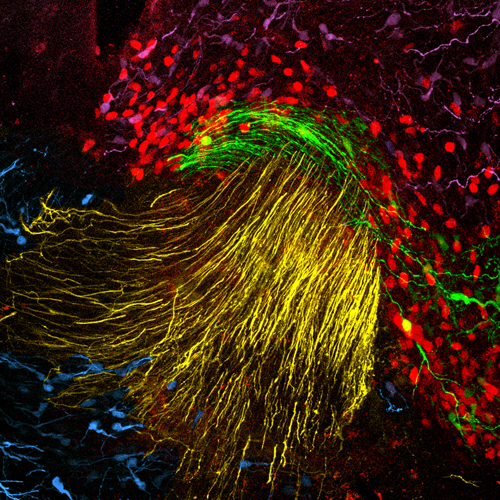 oncogene