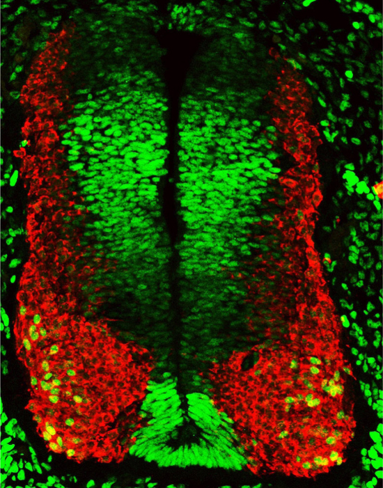 oncogene